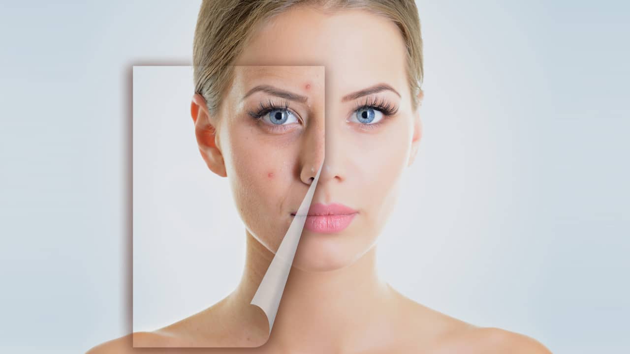 Comment avoir une peau parfaite sans imperfections ?